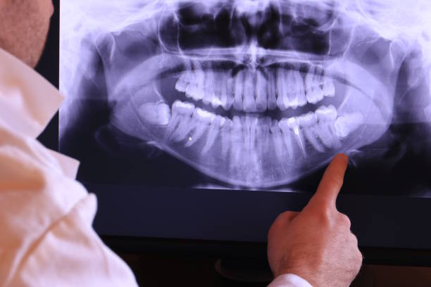 Best Emergency Denture Repair in Keno, OR